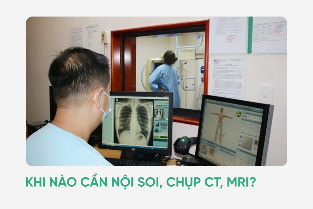Khi nào cần nội soi, chụp CT, MRI?