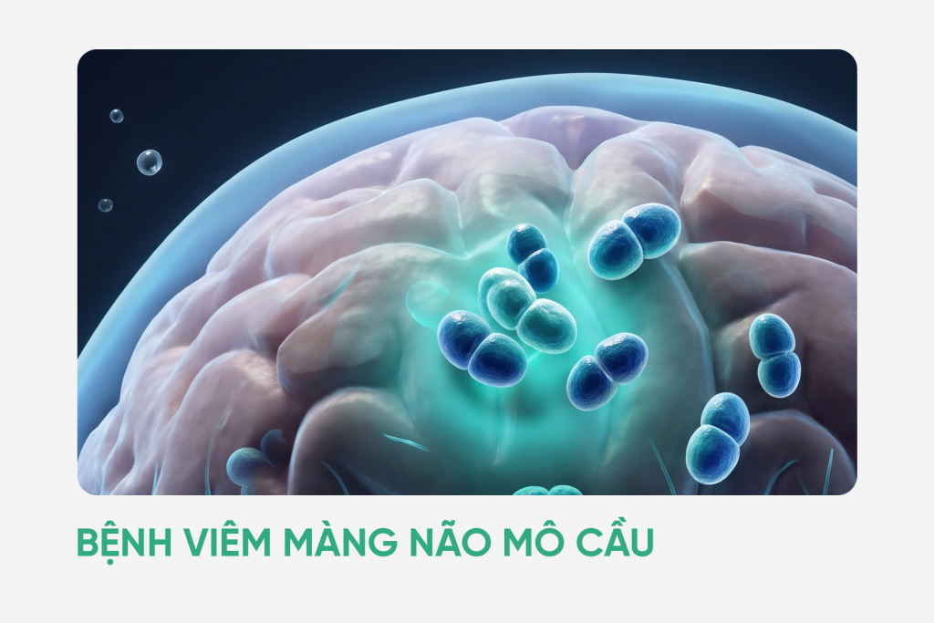 Bệnh viêm màng não mô cầu